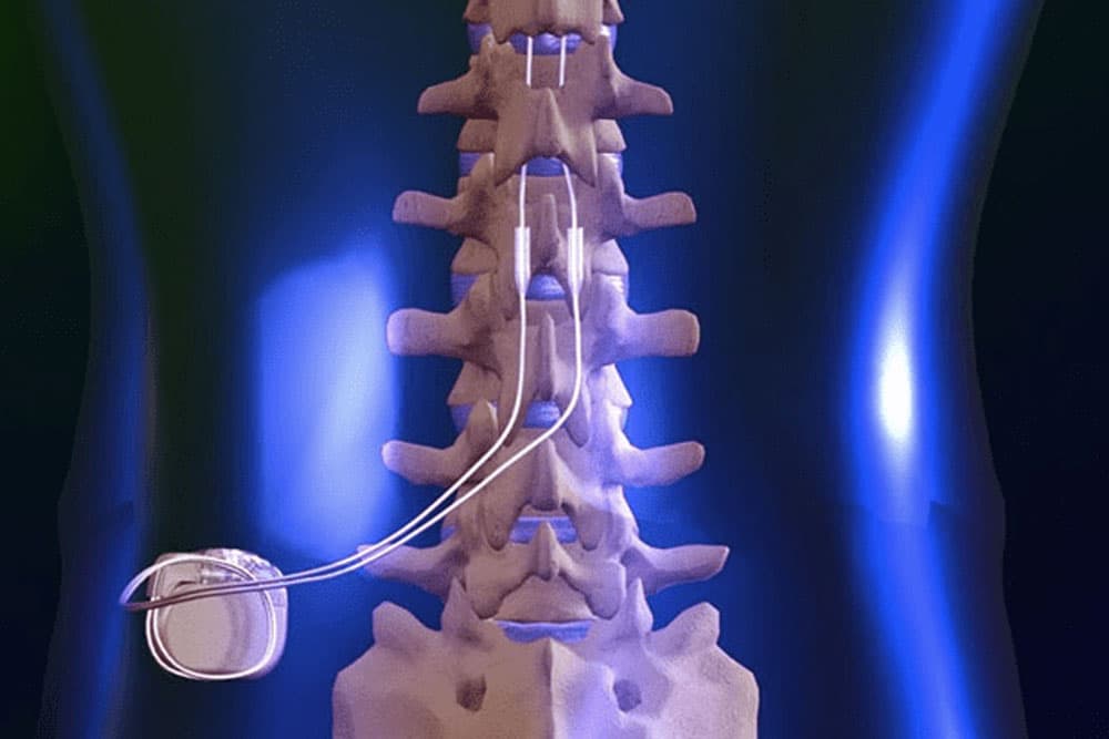 Malama Pain, Spine and Joint Medicine photo 2