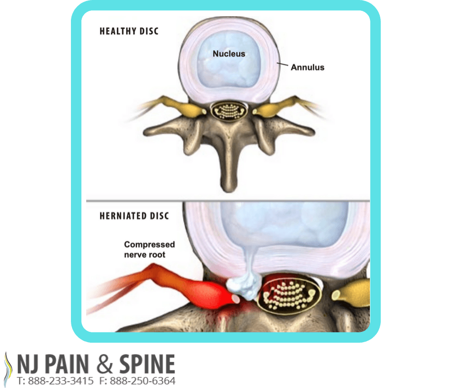 NJ Pain & Spine - Paterson, NJ photo 2