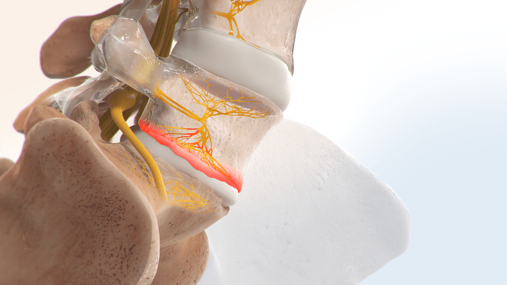 Ohio Valley Pain Institute photo 1