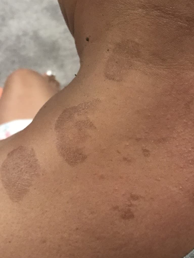 Metro Spine Pain Centers photo 1