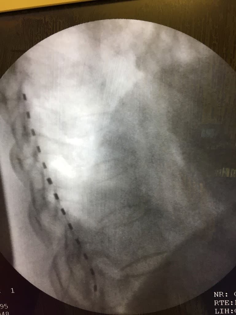 Pain Management Specialists photo 2