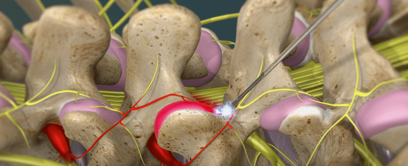 Millennium Pain Center - Bloomington photo 4