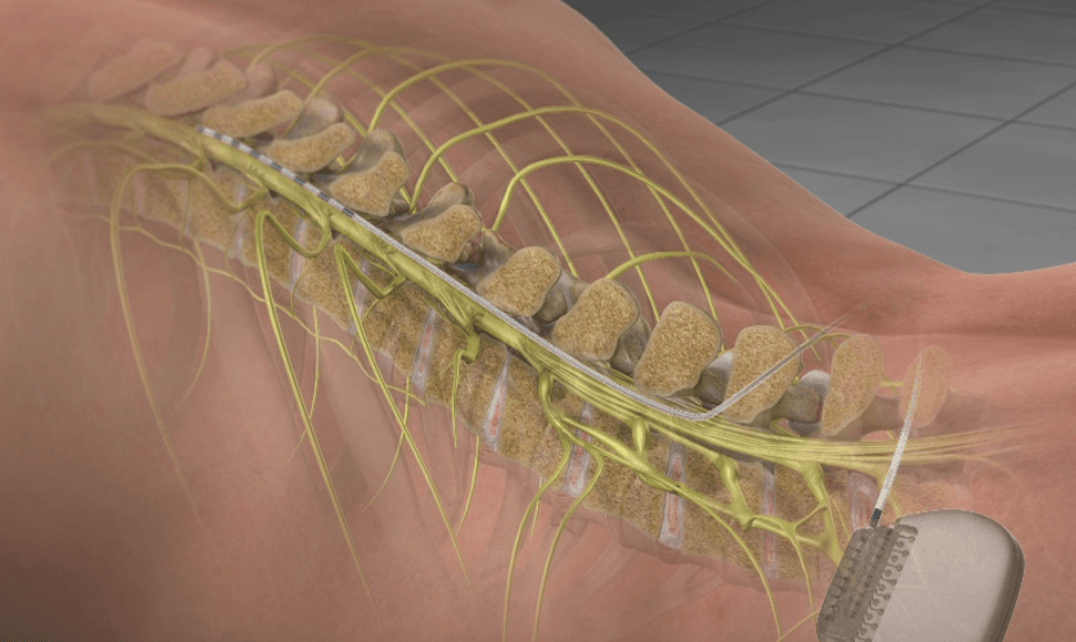 Millennium Pain Center - Bloomington photo 3