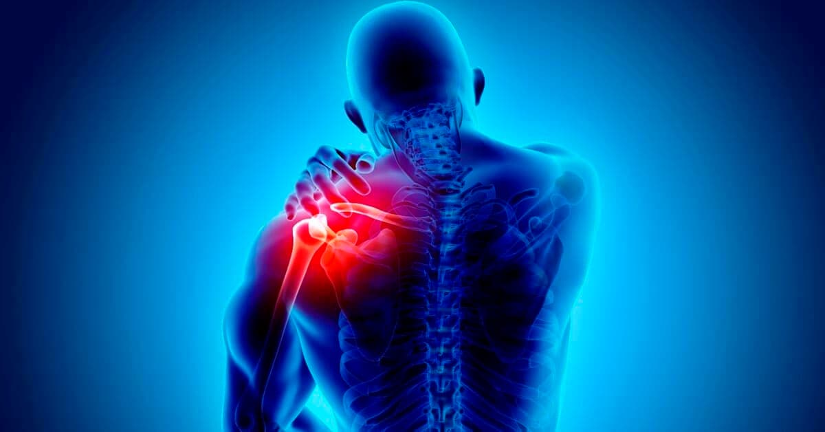 Xray Style image depicting Chronic Shoulder and Back Pain Types