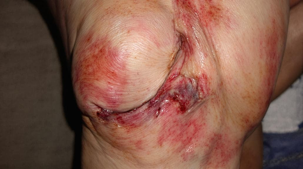 knee pain warning signs