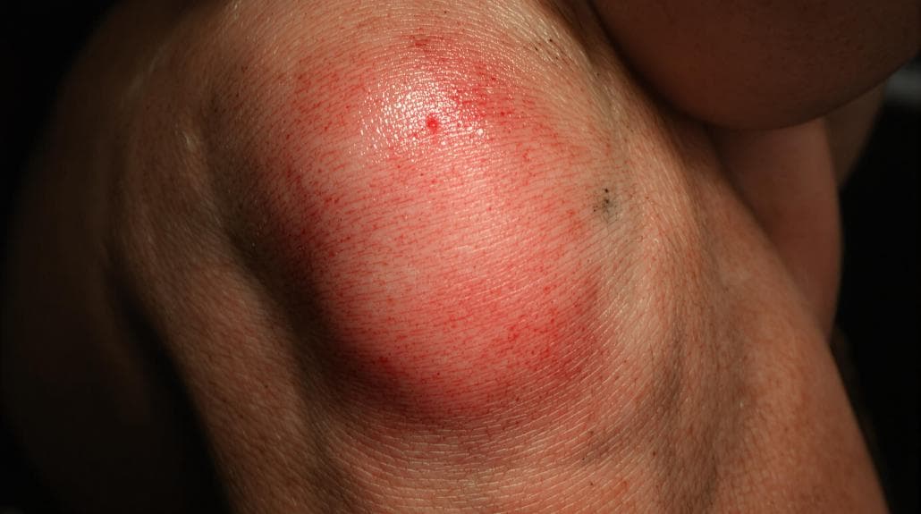 identifying health related indicators