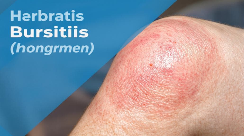 knee bursitis causes treatment options