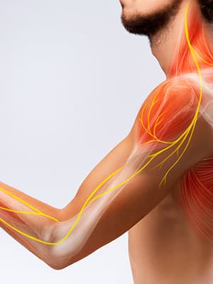 SOLUTIONS Pain and Spine Doctors